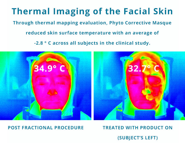 skinceuticals-phyto-corrective-masque-treatment-thermal-image