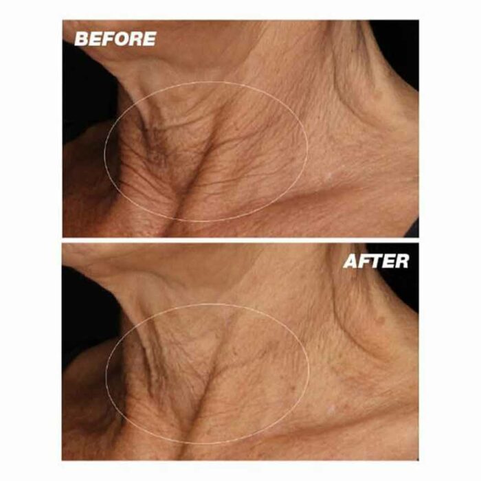 dermalogica-neck-fit-contour-serum-50ml-usage-02